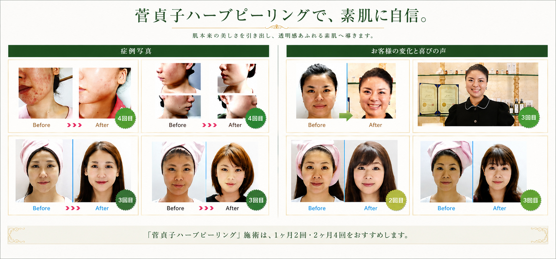 菅貞子ハーブピーリングシリーズ（ハーブパウダー＆ソリューション）セット